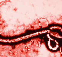 Ebola