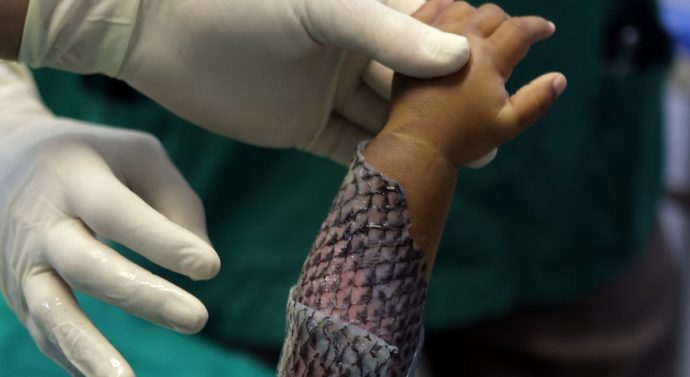 Peștele bun de pus pe rană